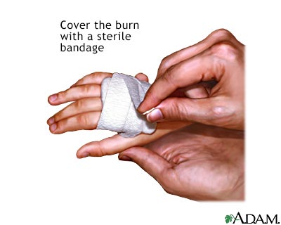 Name:  burntreat2.jpg
Views: 2267
Size:  15.7 KB